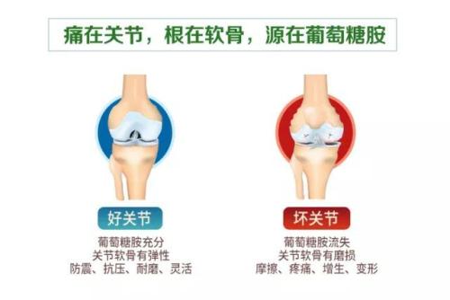 原装进口氨基葡萄糖,氨基葡萄糖进口都有什么牌子