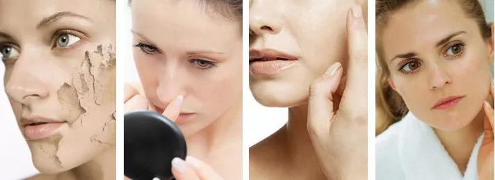 澳洲绵羊油哪款补水保湿效果好,澳大利亚哪个牌子绵羊油滋润保湿