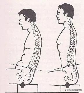 练瑜伽可以矫正骨盆前倾,练瑜伽时骨盆如何转动