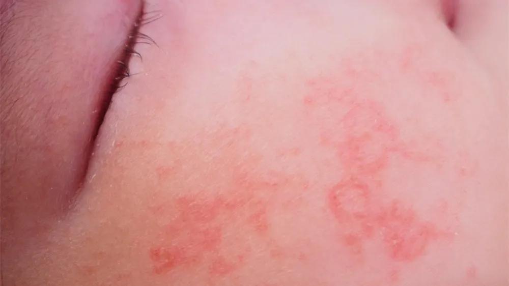 婴幼儿面霜是否有毒,婴儿霜里面的致癌物有哪些