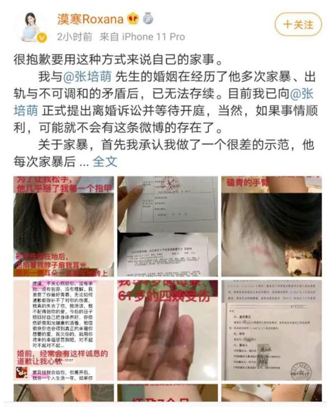 张培萌妻子再度发声,张培萌妻子称只想要抚养权