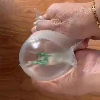 孕期妊娠纹怎么可以彻底消除,不想怀孕的时候要做好措施