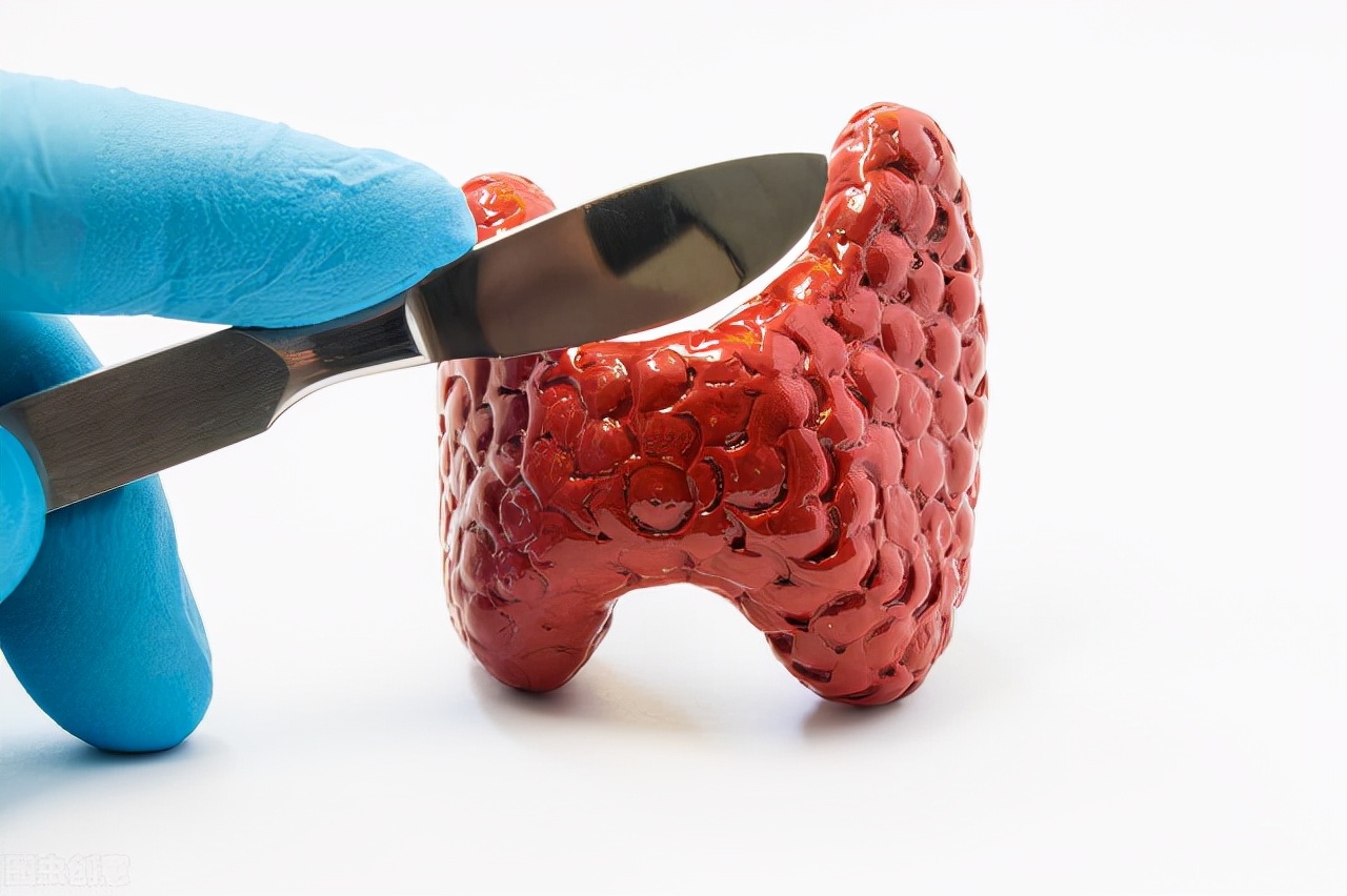 检查报告中,“无回声、低回声、强回声”都是什么意思?