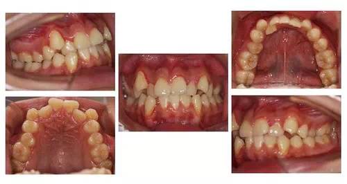 毒液极度纯洁的笑容,毒液笑容