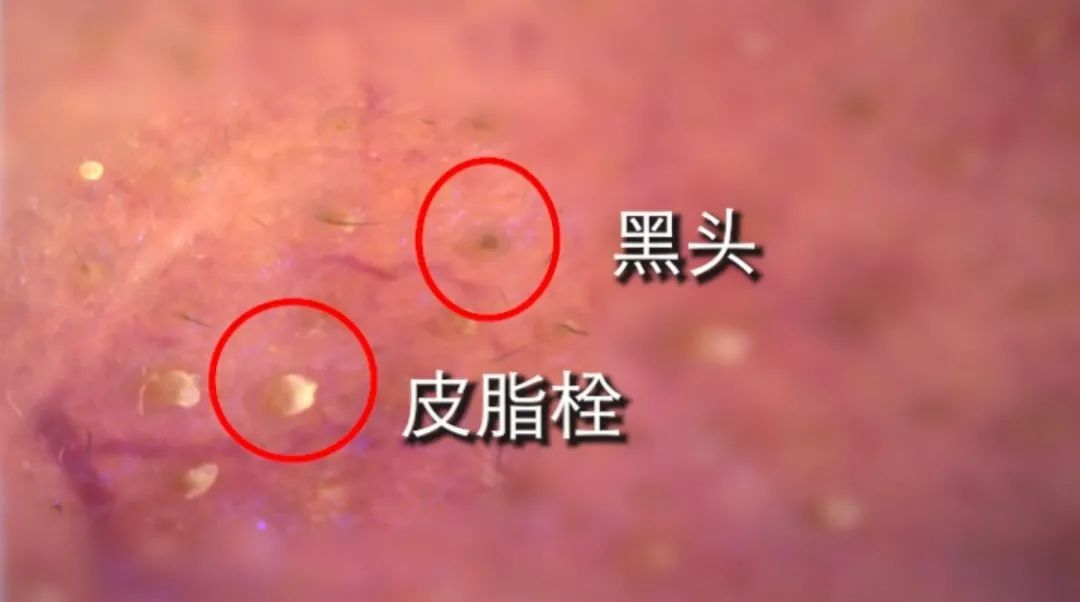 美妆近期火爆款,测评美妆清洁泥膜