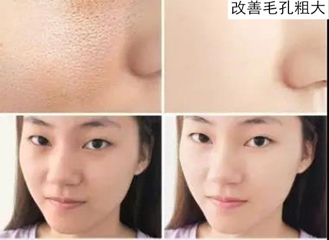 女人刚过30就肤色暗黄？想要“换皮”，先搞清楚这3件事