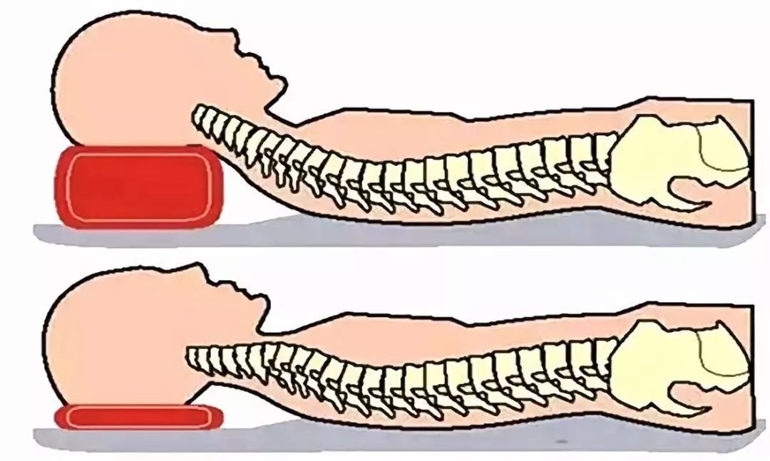 枕头太高会导致哪些疾病,枕头过高出现颈椎病可以自愈吗