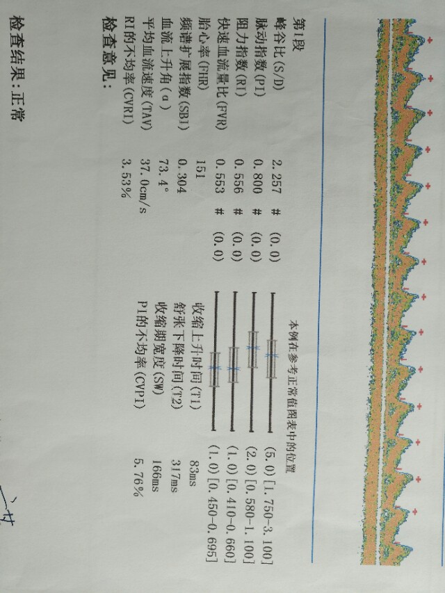 孕期产检全流程一次性说清楚了,孕期检查全流程