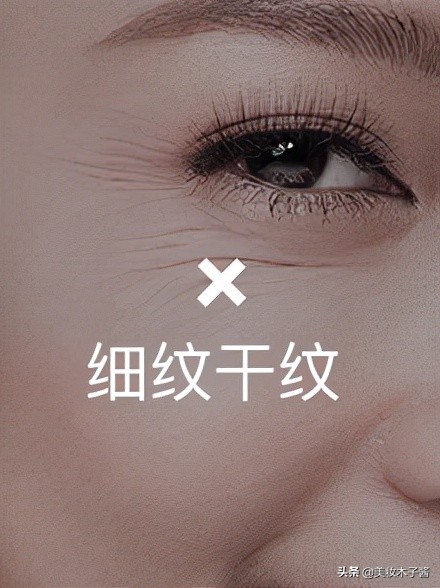 眼周提升方法,眼周提升正确手法