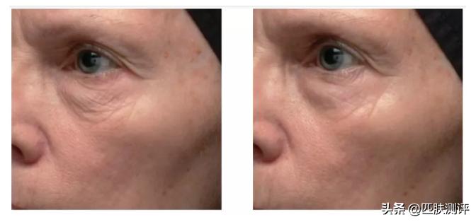 olay超a瓶,olay新升级超亮瓶测评