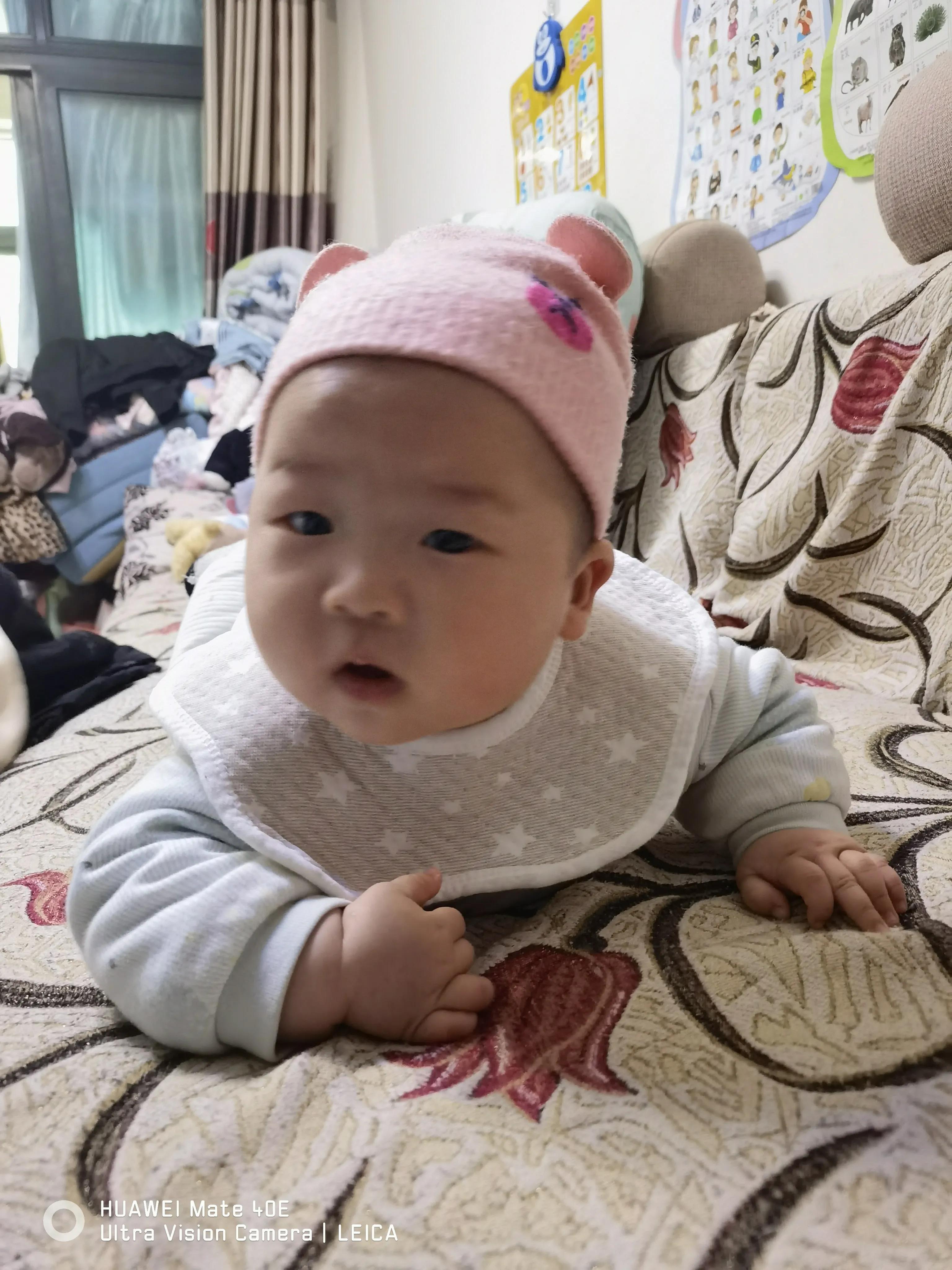 你还在为湿疹烦恼吗,湿疹真的那么恼人吗