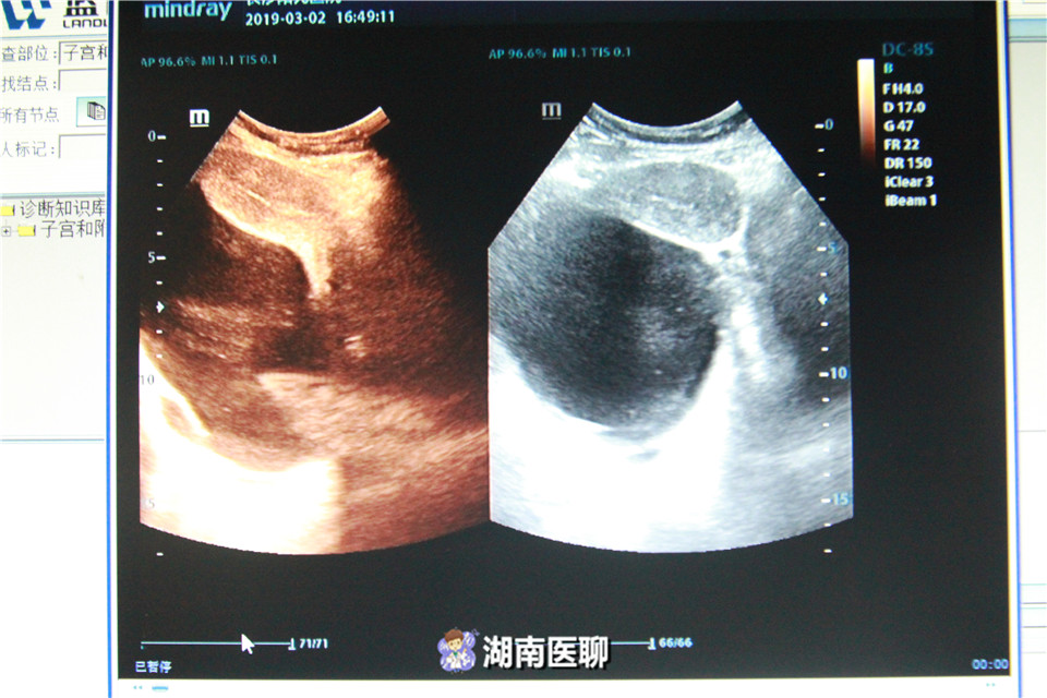 女性备孕3个月没怀上,备孕很久都没怀上的女人怎么了