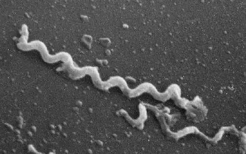 日本2019年传染病实况:得梅毒的孕妇越来越多,原因竟是老公孕期出轨