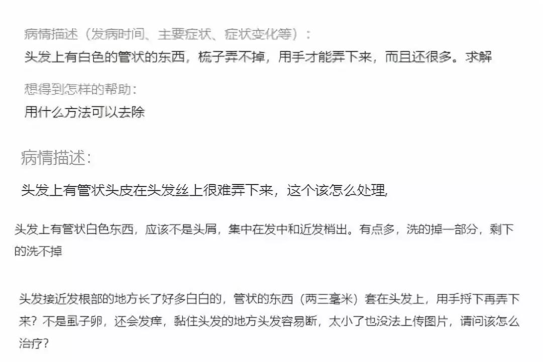 可怕！孩子头发上的白点点，竟然不是头皮屑！