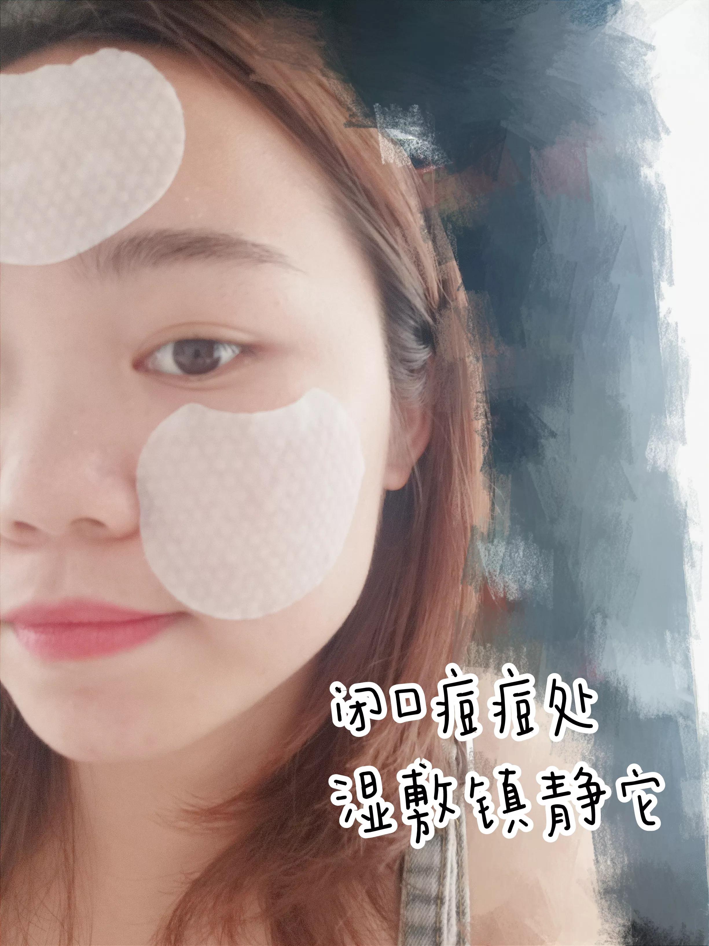 刷酸烂脸的小妙招,刷酸害怕爆皮怎么办