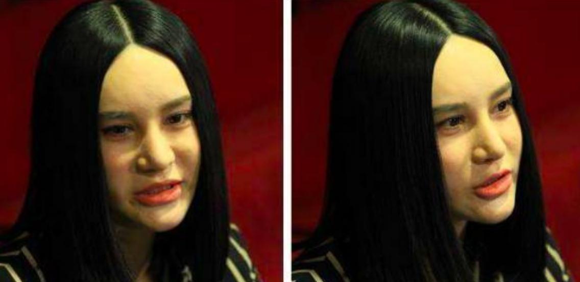 打玻尿酸显老网红,打玻尿酸成功的明星