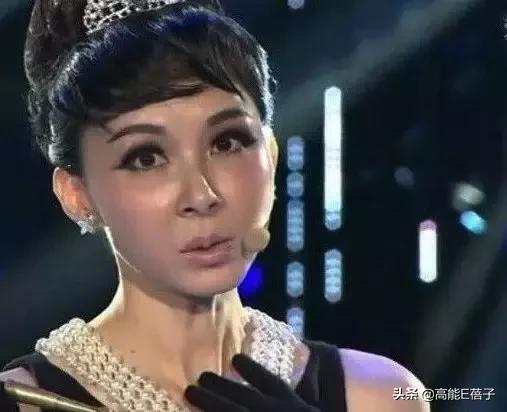 微整形需要多久,最受欢迎的5大微整形