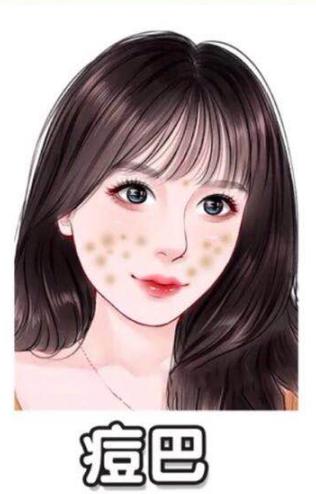 有效简单的祛除痘印的方法,6大方法有效祛除痘印