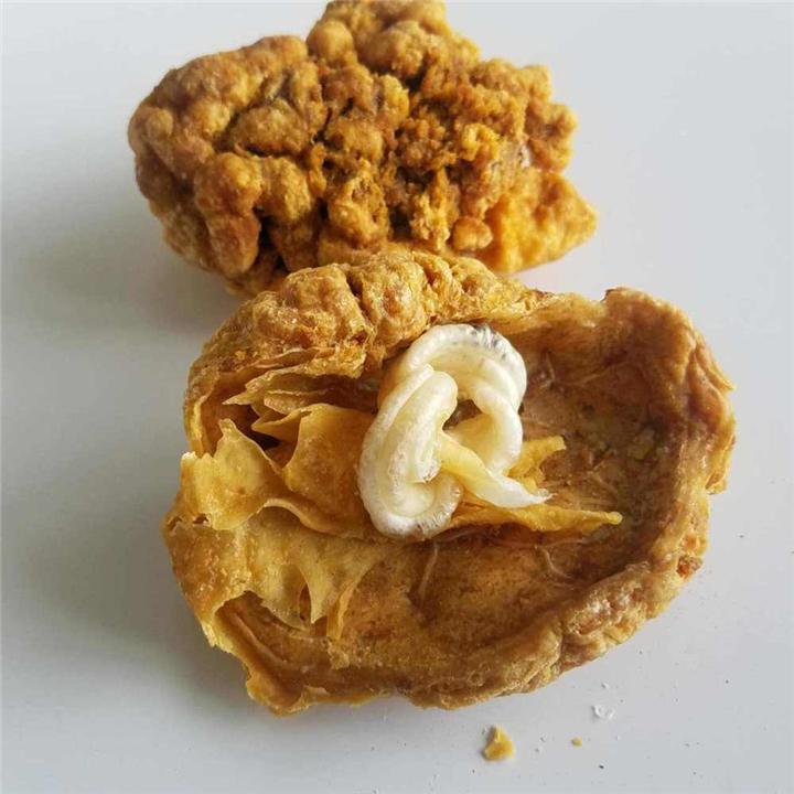 生完孩子后胎盘是怎么处理的,生完孩子胎盘一般是怎么处理