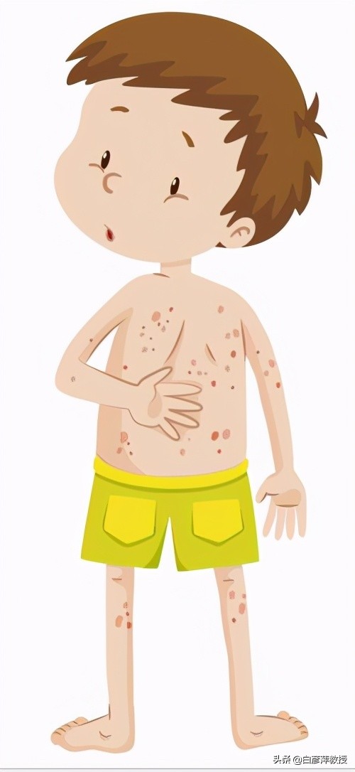 头发半天就油了怎么回事,脂溢性皮炎会出现丘疹吗