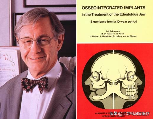 一篇文章带您走过种植体的前世今生