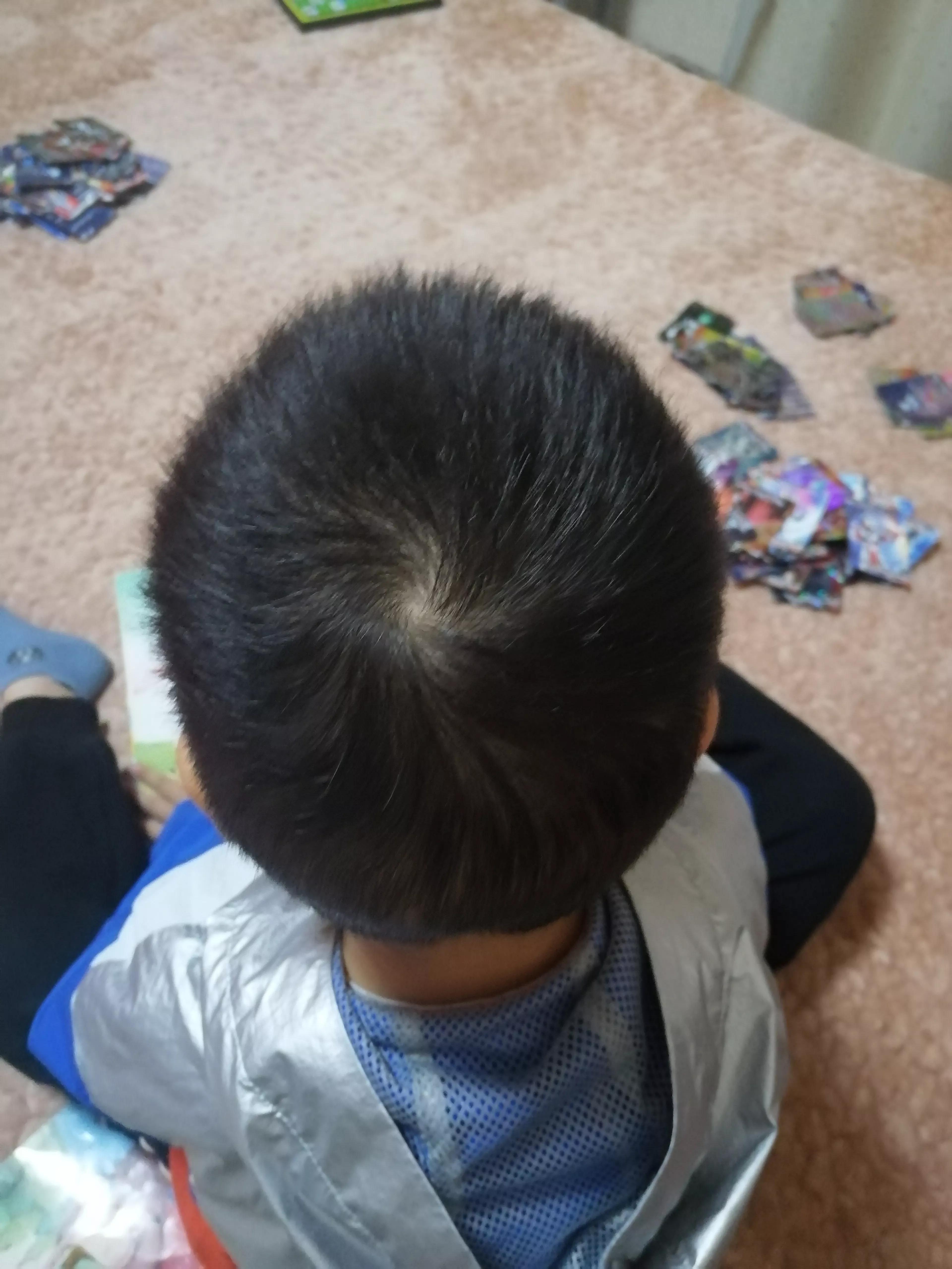 头上的旋的位置有什么说法,娃头上的旋有啥讲究