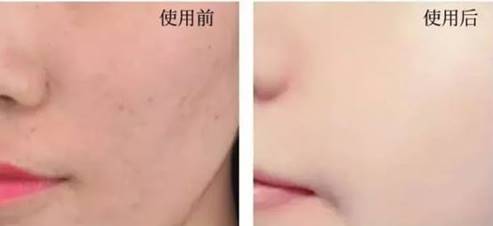 2019上黑名单的洗面奶前十,洗面奶黑名单