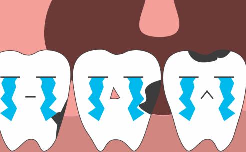 孕期牙疼是什么原因引起的,孕期导致的牙疼多久能好