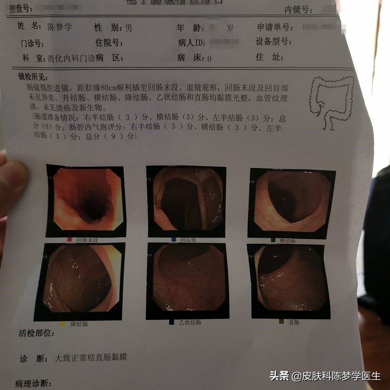 医生无麻醉给自己做了个胃肠镜,我是医生免费观看完整版