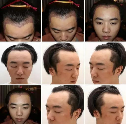 华晨宇“整容”事件再度发酵，流量巨星能否再立人设