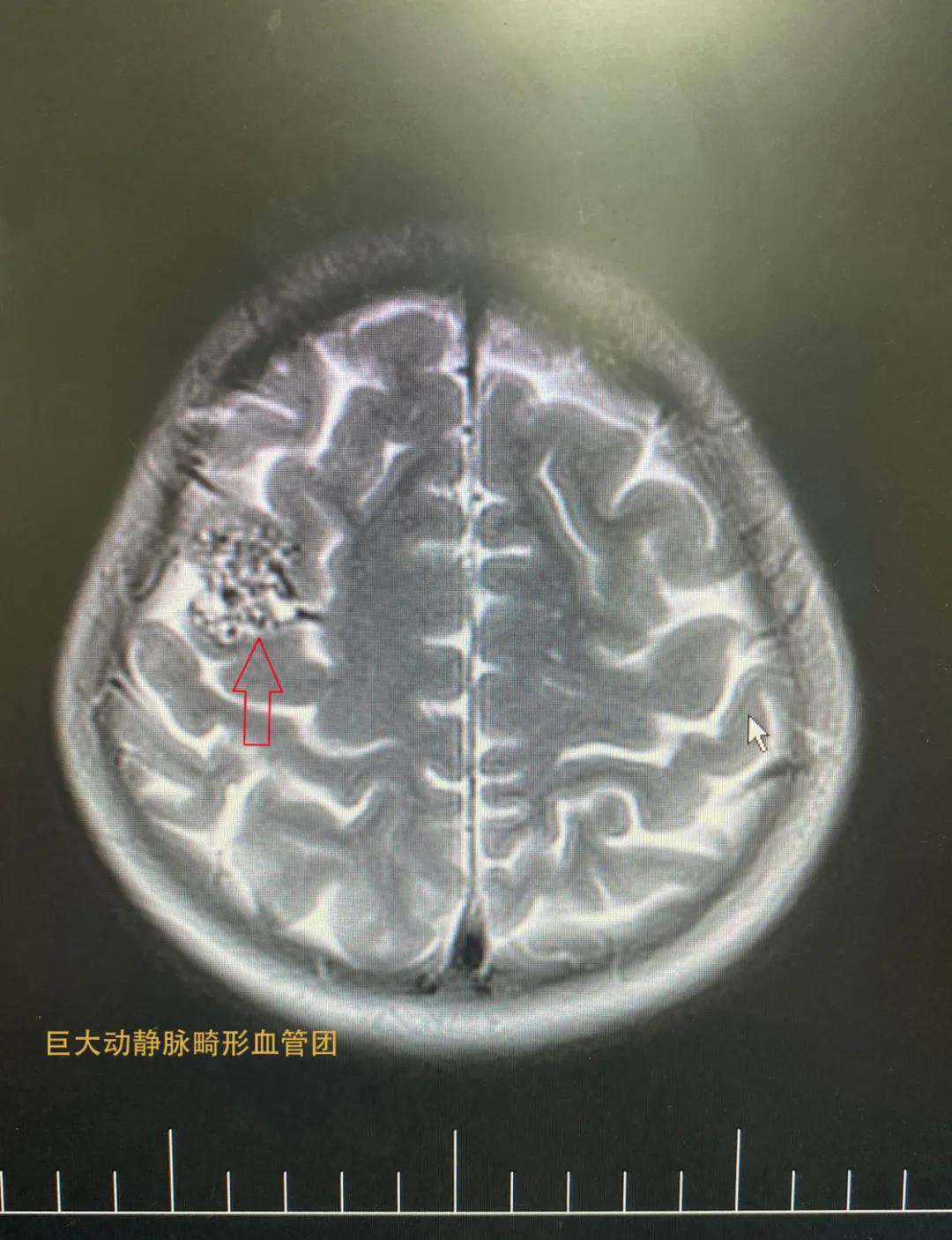 普洱市人民医院神经内科,思茅区人民医院神经外科