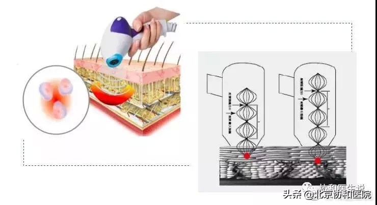 40岁女性适合的身体整形医美项目,40岁的女人整形手术