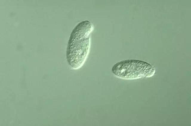 收藏!24种污水处理微生物菌相及指导意义,环保人必看(多图)