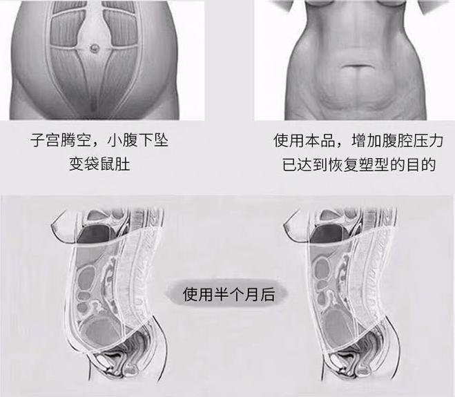 网红爆款束腹带,抖音爆款束腹带