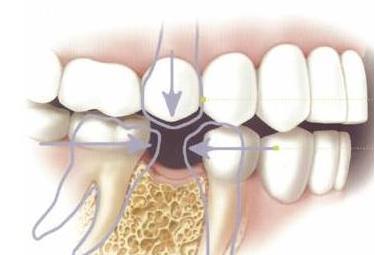 牙齿那些事微课,牙齿的问题都是小事