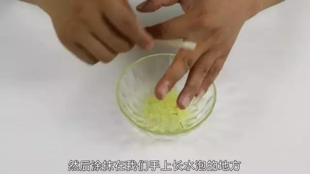 天热手上起水泡怎么回事,天气一热手上就长小水泡怎么回事