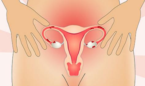 肝气郁结痛经和宫寒痛经,宫寒为什么会引起痛经