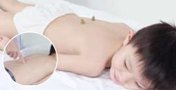 中医治流口水的推拿,小儿流口水灸什么穴位