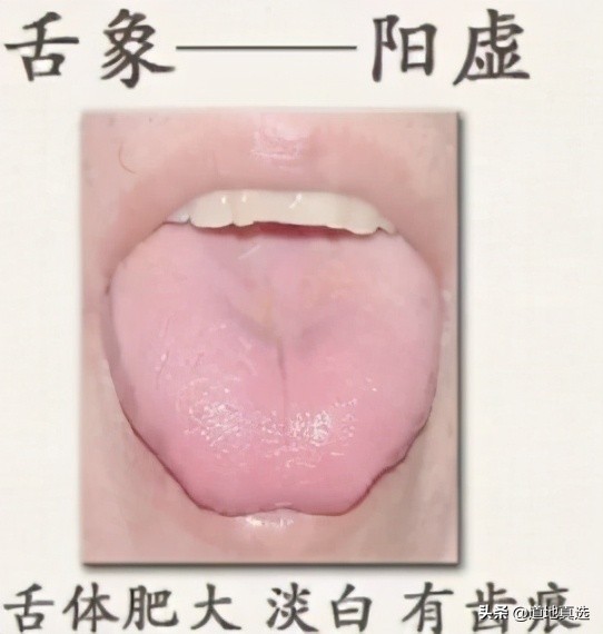 珍贵的舌诊图谱，看舌头知健康，人手一份！你也能快速识别疾病