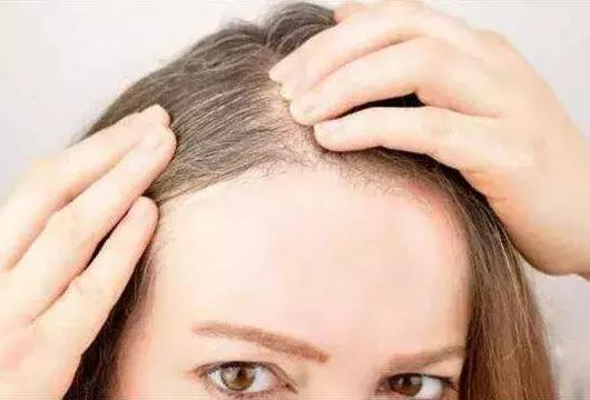 女性老是吃甜食好不好,女人偶尔吃甜食的危害