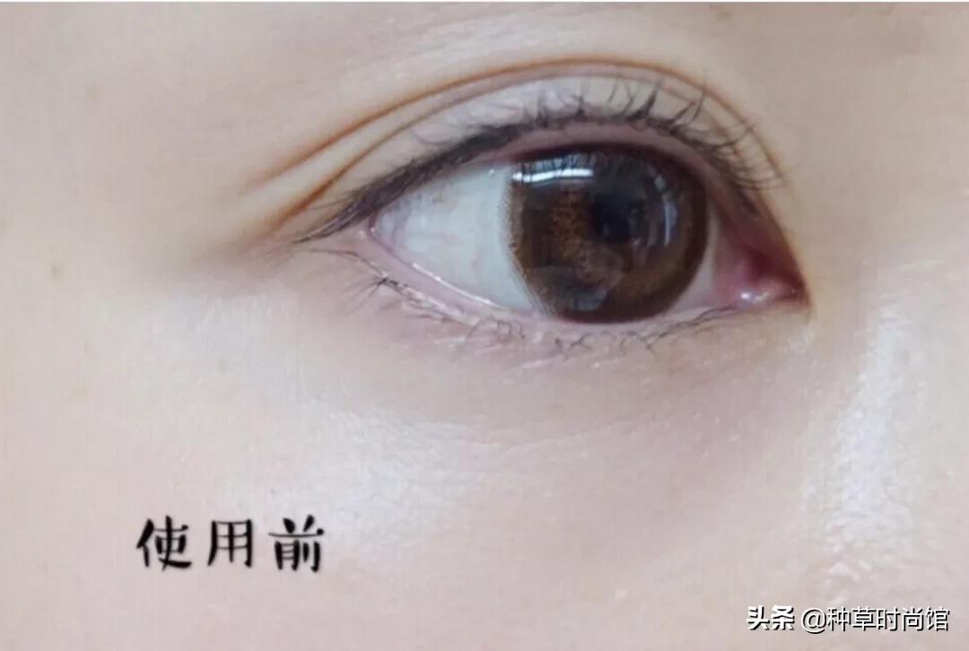 浣犵殑鐪奸湝鏄孩姒滃悧,浣犵殑鐪艰啘鏄笉鏄创閿欎簡