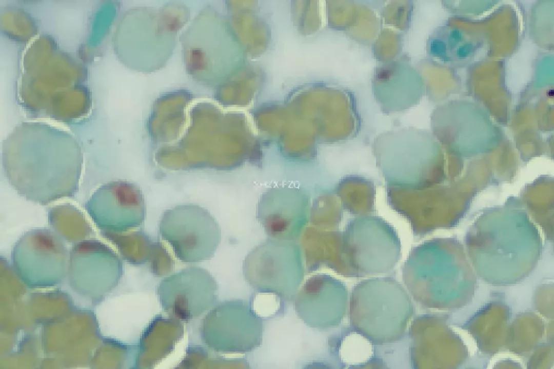 粒单不决问组化?有时还真不一定...