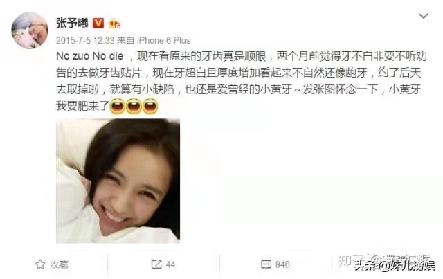 烤瓷牙美白注意事项,烤瓷牙选错颜色有点黄如何美白