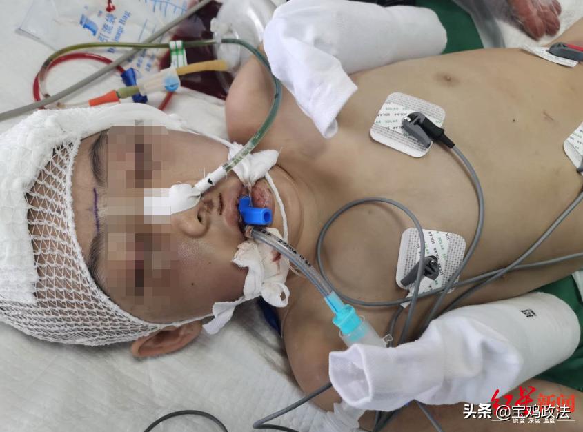 12岁女孩被继母虐待致脑梗死,女童疑遭继母虐待身亡