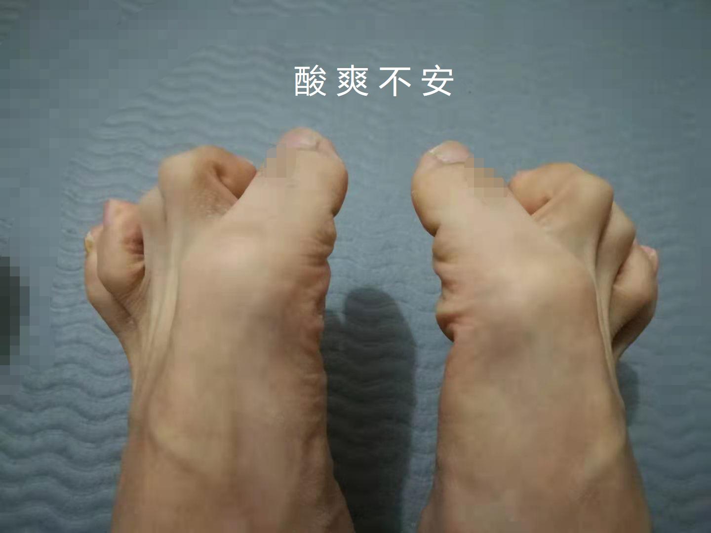 菊促不安？做完肛拭子变成企鹅步？其中酸爽推测，助你掌控全菊