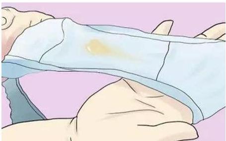 为什么同房后*裤内**有血？医生：小心这些病