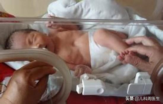 犬吠样咳嗽伴有呼噜声怎么缓解,哪些病会引起犬吠样咳嗽