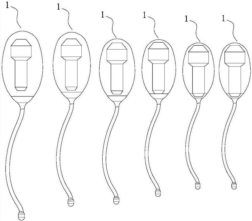 盆底康复治疗是怎么治疗的,盆底康复治疗有哪些