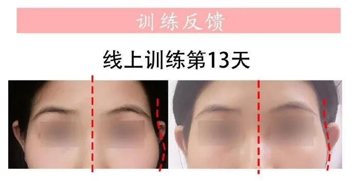 改善太阳穴脸颊凹陷的修容,改善太阳穴凹陷的面部动作