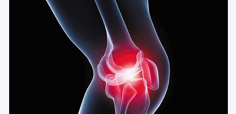 骨关节炎康复治疗方案,骨关节炎康复科普知识宣传